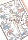 ミステリアスな古本　☆医療　　医学　薬学の歴史と文化　　薬学　　リウマチ性疾患他　　中世　イラスト　70年代