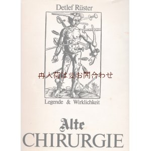 画像: 楽しい古本☆　（閲覧注意）　昔の外科　手術　とその歴史に関する古書　イラスト多数　　